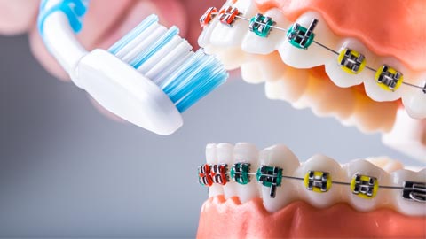 Controversies in Orthodontics — Fact vs Fiction thumbnail